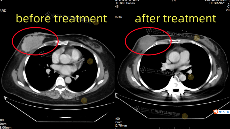 1-075022466.png 李女士.png